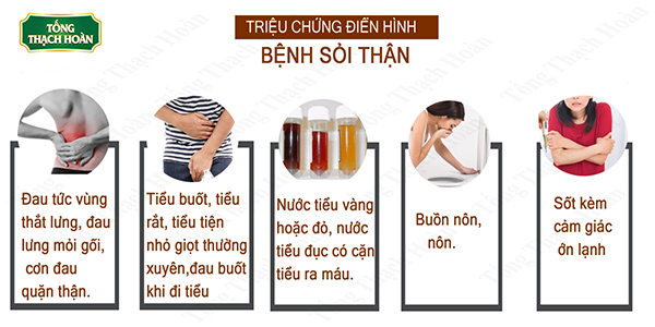 Dấu hiệu khi bị sỏi thận