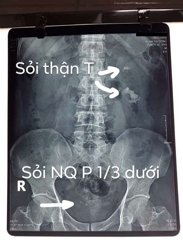 Ha Noi Soi Chu Dong 3