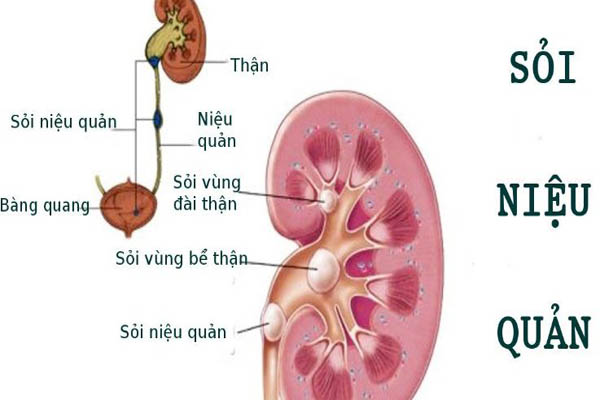 tt soi nieu quan 1